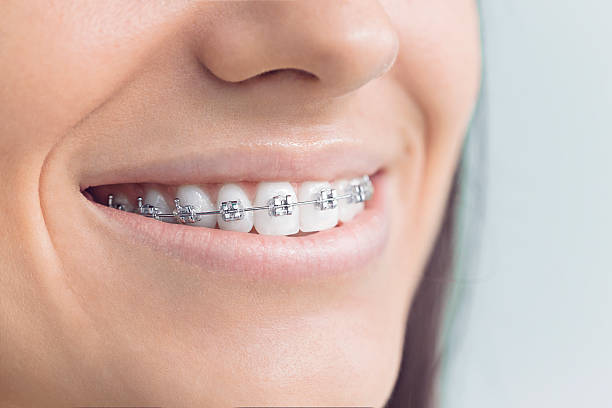 Best Wisdom Tooth Removal  in East Rochester, NY